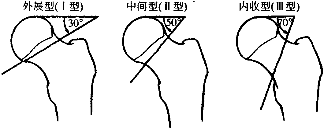 病因與分型